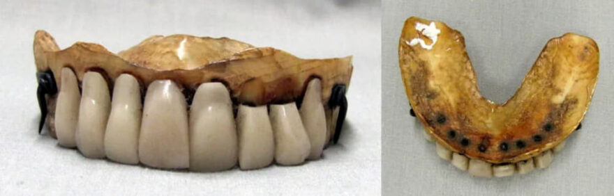 zubi-yak-znaxidka-primiryati-budete-4024508