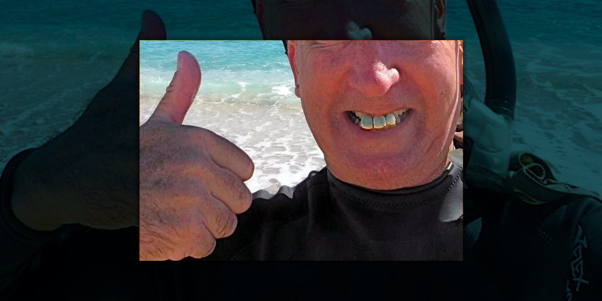 Зуби як знахідка. Приміряти будете?