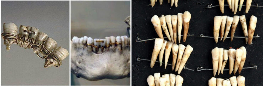 zubi-yak-znaxidka-primiryati-budete-4566796