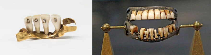 zubi-yak-znaxidka-primiryati-budete-4571826